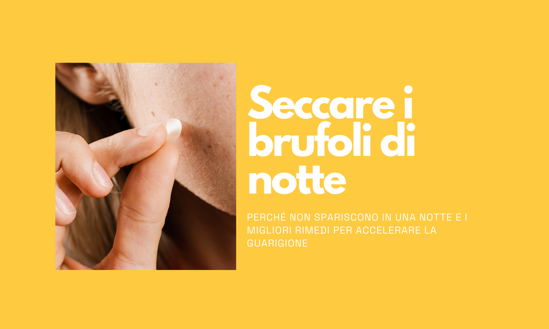 Brufoli: Perché Non Spariscono in una Notte e i Migliori Rimedi per Accelerare la Guarigione