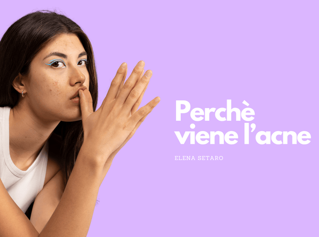 Perché viene l'acne? Scopri le cause e i migliori trattamenti per una pelle sana - Dermaself