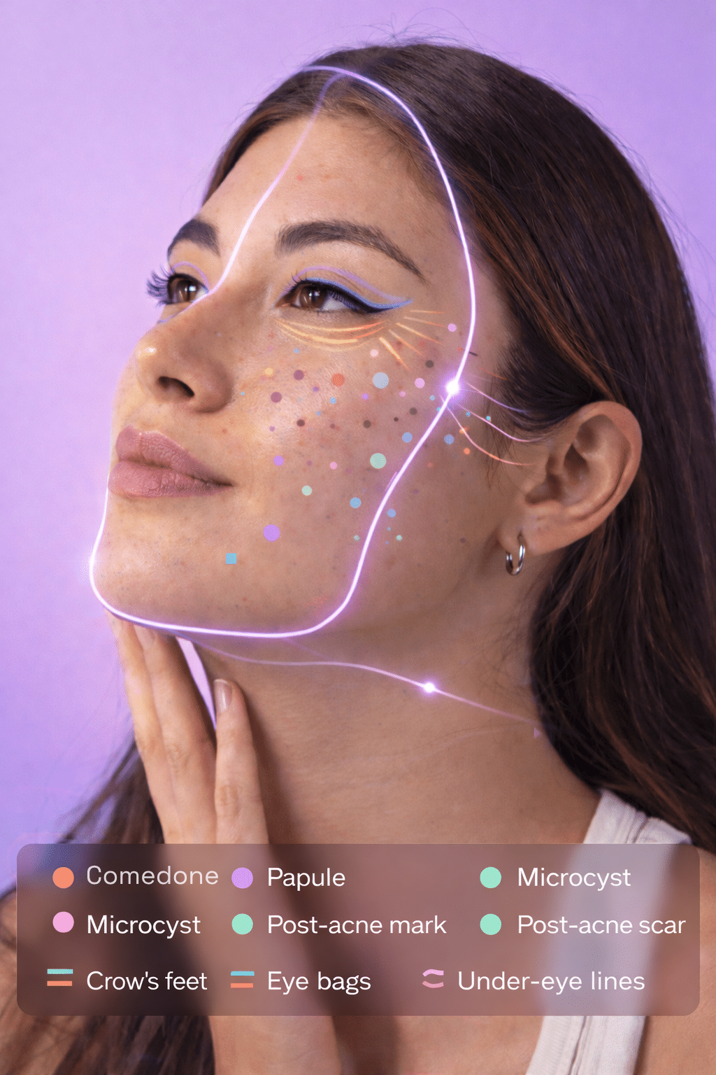 Analisi della pelle del viso con legenda dei tipi di acne